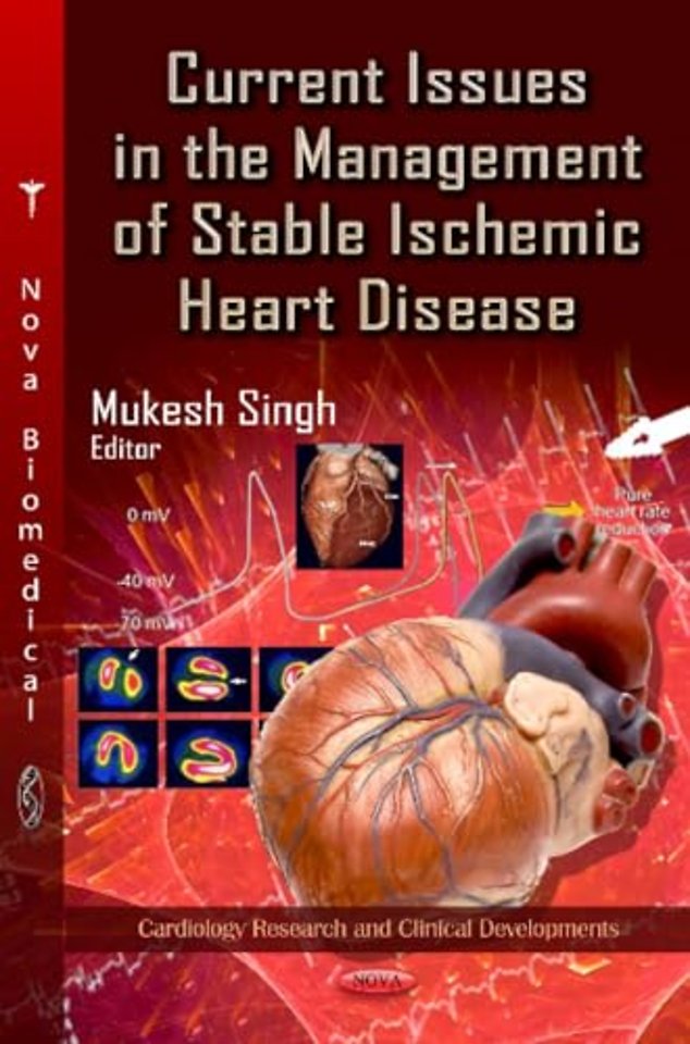 Current Issues in the Management of Stable Ischemic Heart Disease