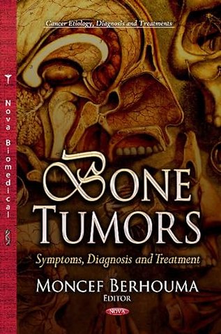 Bone Tumors