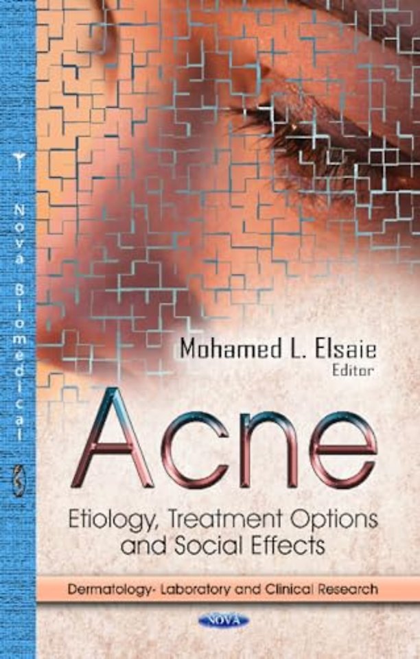 Acne