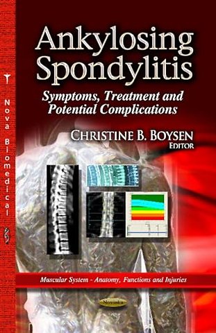 Ankylosing Spondylitis