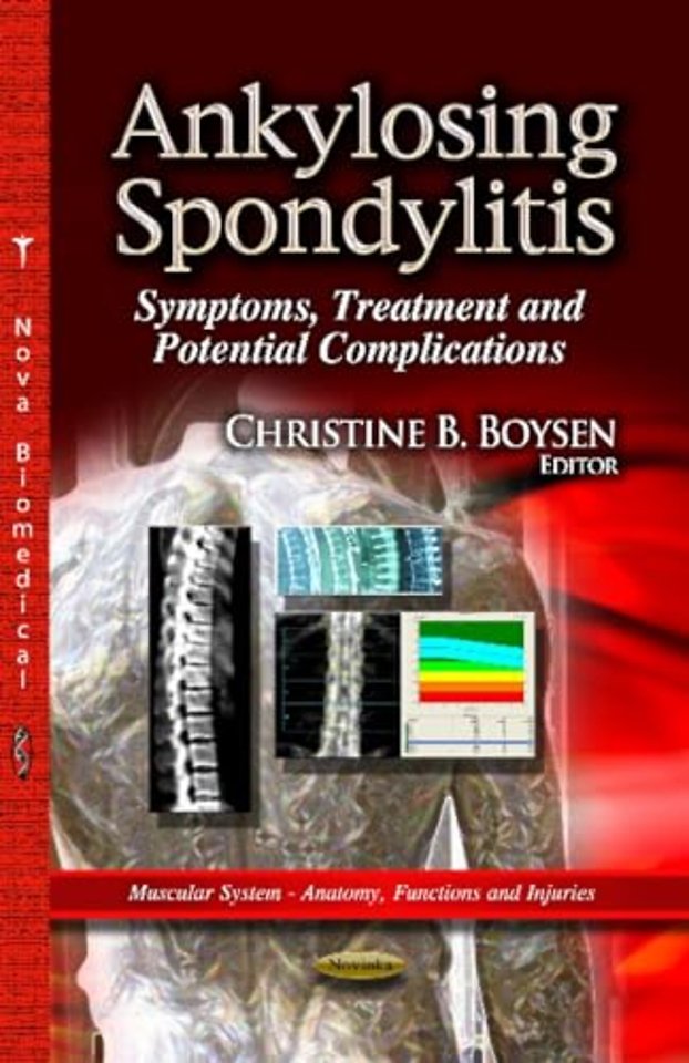 Ankylosing Spondylitis