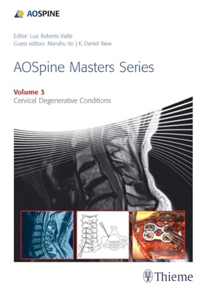 AOSpine Masters Series Volume 3: Cervical Degenerative Conditions