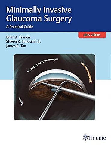 Minimally Invasive Glaucoma Surgery – A Practical Guide
