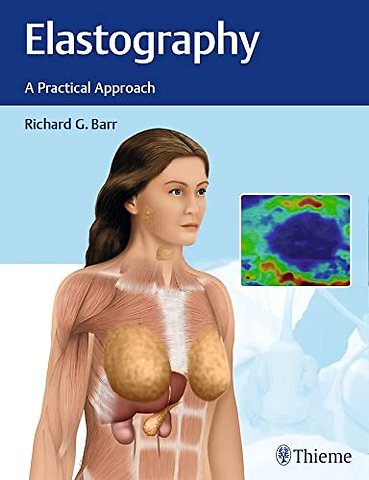 Elastography – A Practical Approach