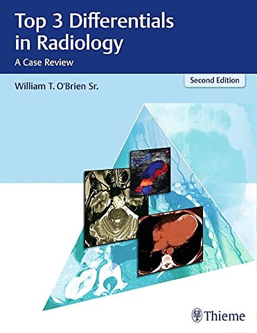 Top 3 Differentials in Radiology – A Case Review