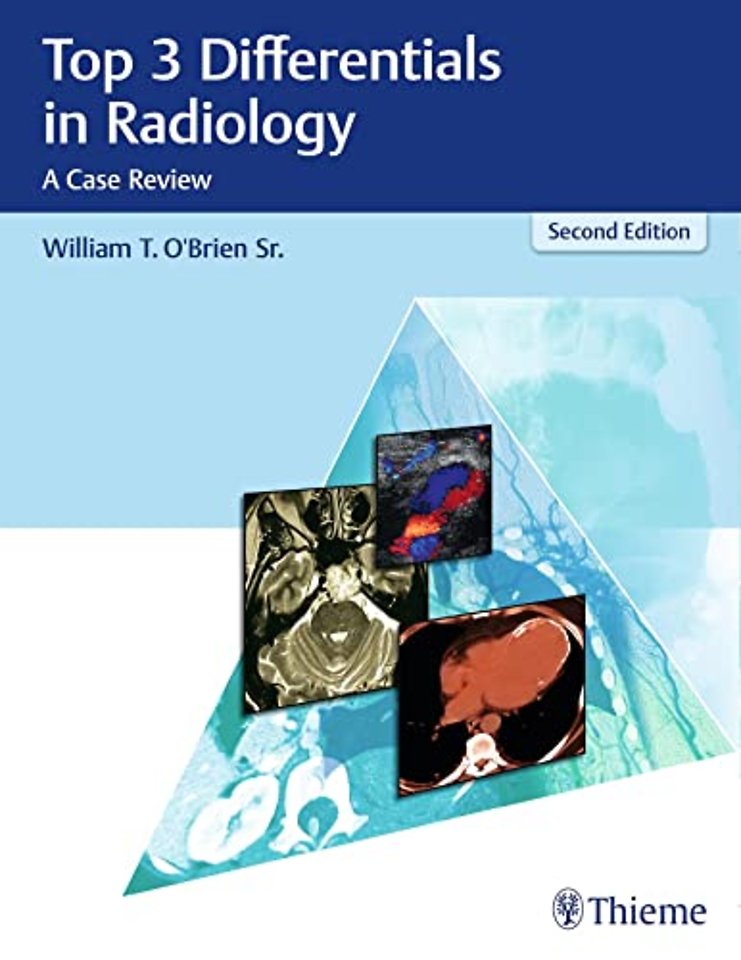Top 3 Differentials in Radiology – A Case Review
