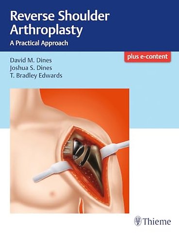 Reverse Shoulder Arthroplasty – A Practical Approach