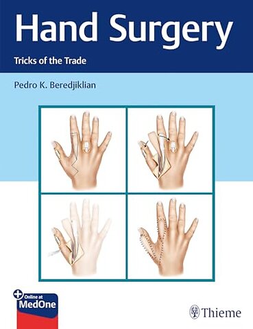 Hand Surgery