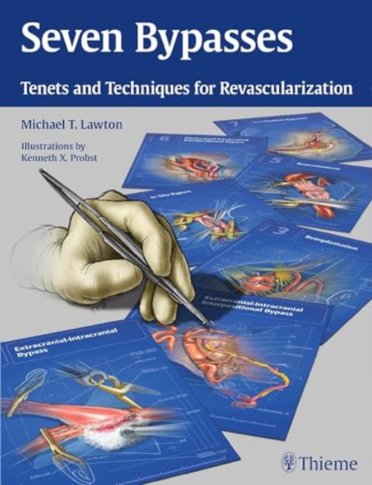 Seven Bypasses – Tenets and Techniques for Revascularization