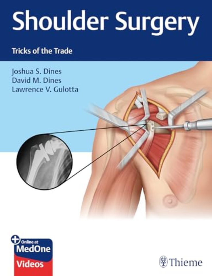 Shoulder Surgery – Tricks of the Trade