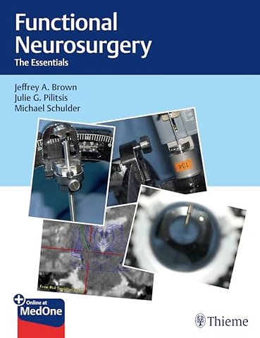 Functional Neurosurgery – The Essentials
