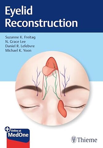 Eyelid Reconstruction