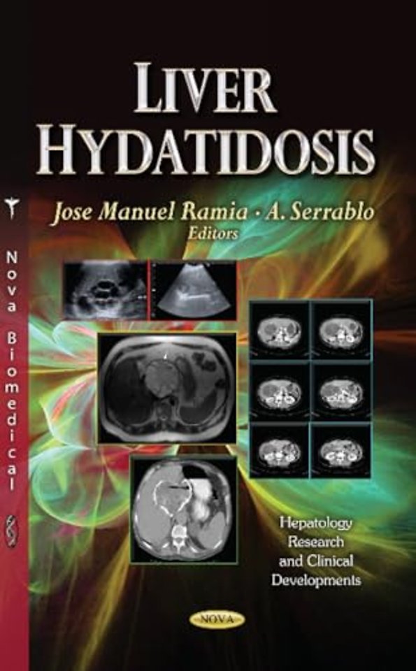 Liver Hydatidosis