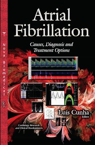 Atrial Fibrillation