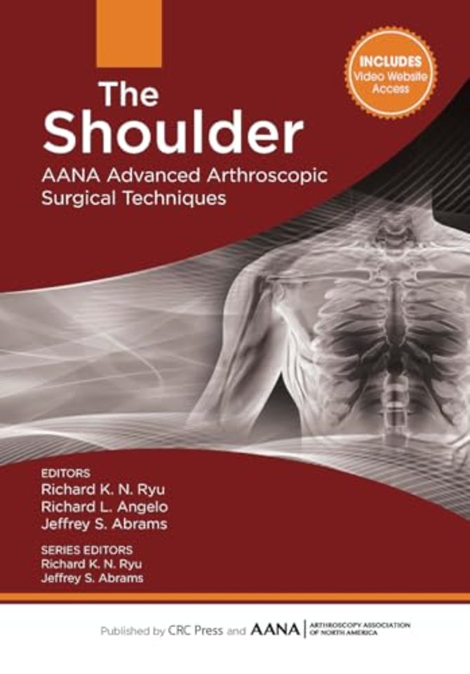 The Shoulder