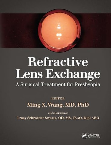 Refractive Lens Exchange
