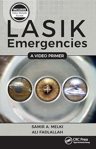 LASIK Emergencies: A Video Primer