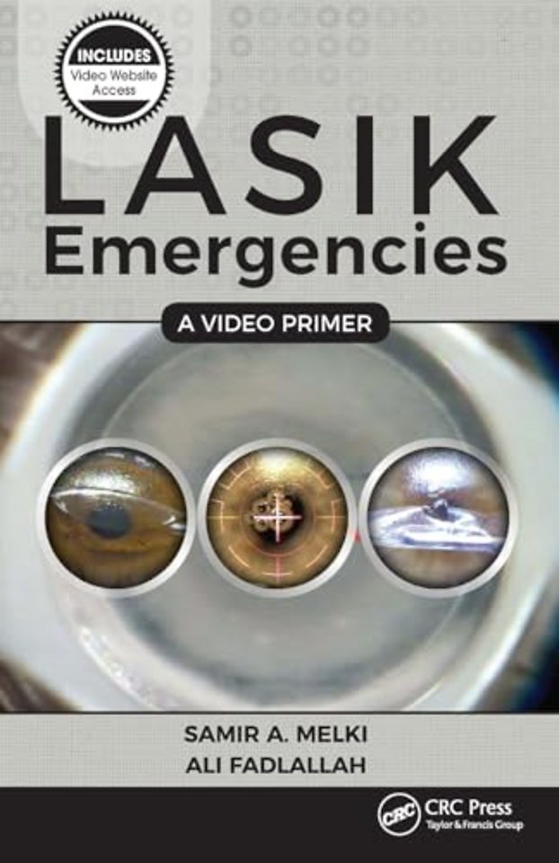 LASIK Emergencies: A Video Primer