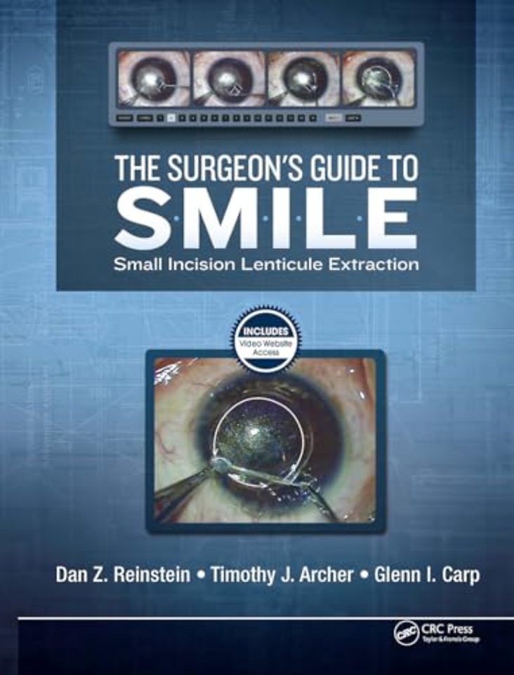 The Surgeon’s Guide to SMILE