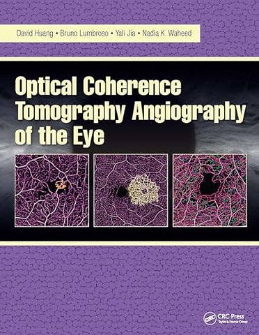 Optical Coherence Tomography Angiography of the Eye