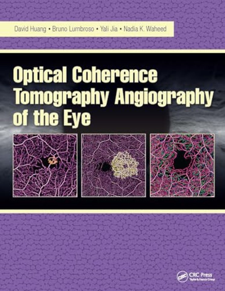 Optical Coherence Tomography Angiography of the Eye