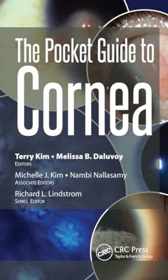The Pocket Guide to Cornea