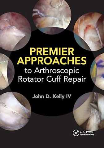 Premier Approaches to Arthroscopic Rotator Cuff Repair