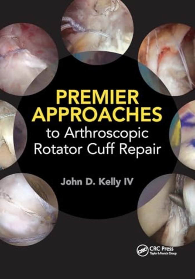 Premier Approaches to Arthroscopic Rotator Cuff Repair