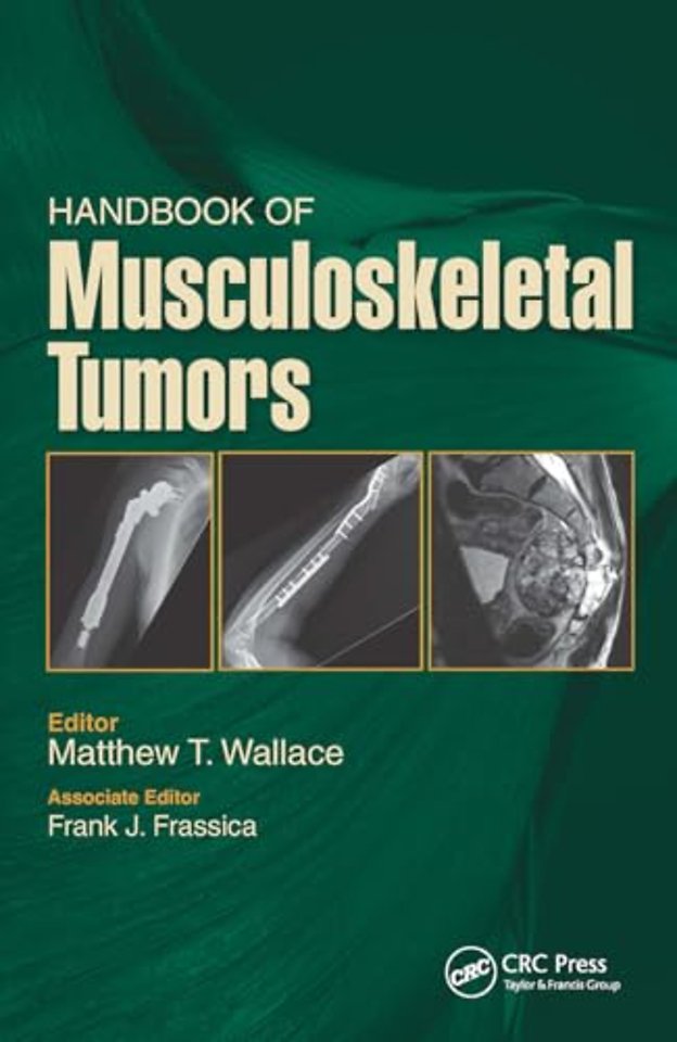 Handbook of Musculoskeletal Tumors