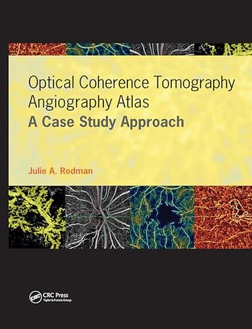 Optical Coherence Tomography Angiography Atlas