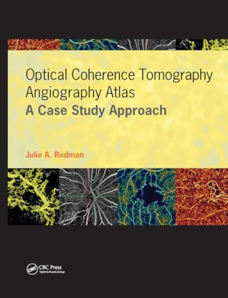 Optical Coherence Tomography Angiography Atlas