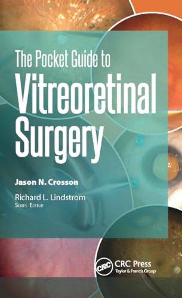 The Pocket Guide to Vitreoretinal Surgery