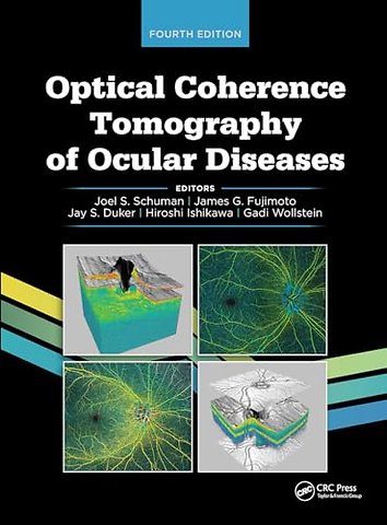 Optical Coherence Tomography of Ocular Diseases