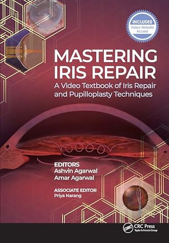 Mastering Iris Repair