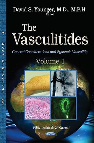 Vasculitides