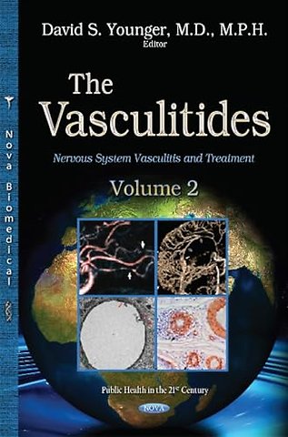 Vasculitidies