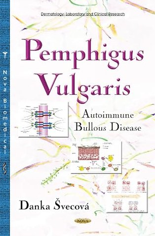 Pemphigus Vulgaris