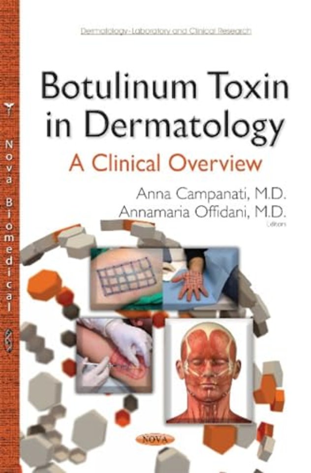 Botulinum Toxin in Dermatology