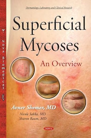Superficial Mycoses