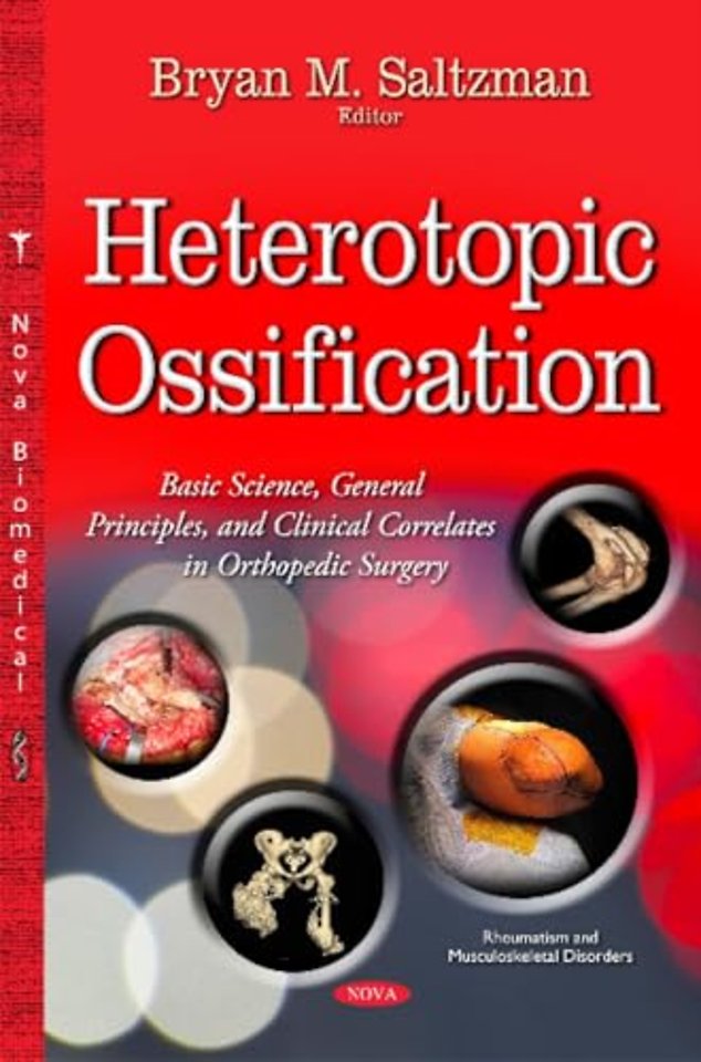 Heterotopic Ossification