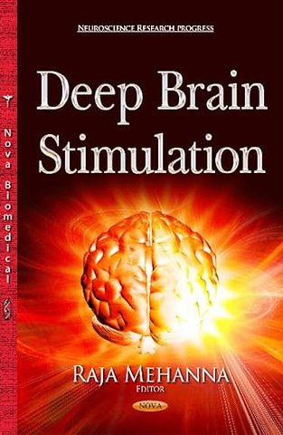 Deep Brain Stimulation