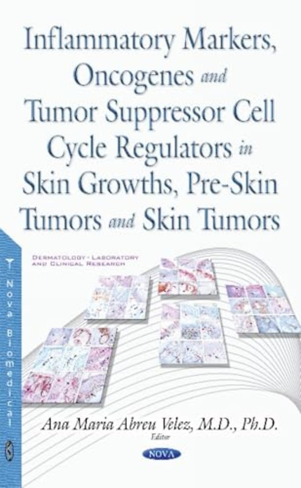Inflammatory Markers, Oncogenes, Tumor Suppressor Cell Cycle Regulators in Skin Growths, Pre-Skin Tumors & Skin Tumors