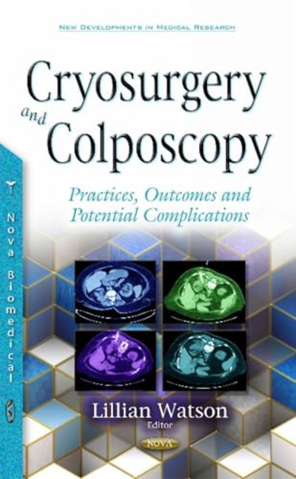 Cryosurgery & Colposcopy