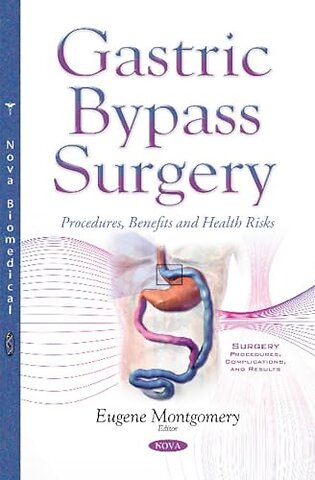Gastric Bypass Surgery