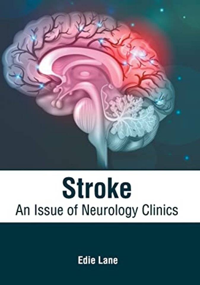 Stroke: An Issue of Neurology Clinics