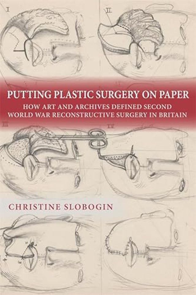 Putting Plastic Surgery on Paper – How Art and Archives Defined Second World War Reconstructive Surgery in Britain