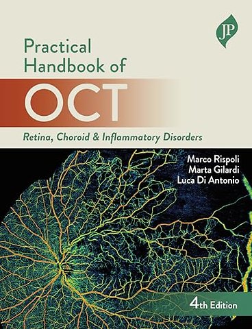 Practical Handbook of OCT