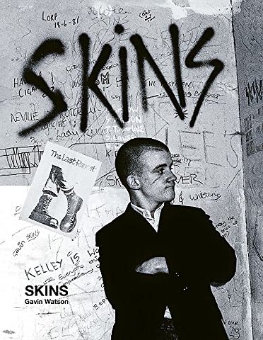Skins - Special Edition