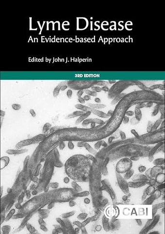 Lyme Disease – An Evidence–based Approach