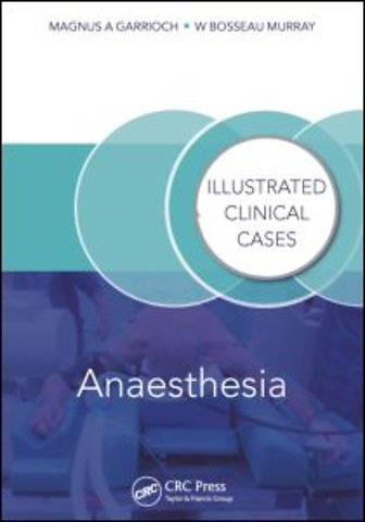 Anaesthesia